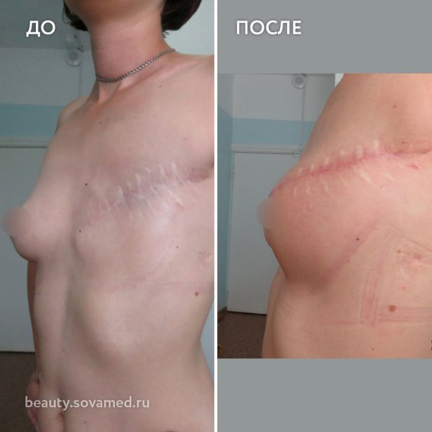 Фото Центр пластической хирургии 23