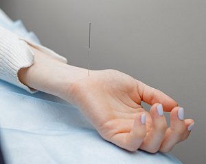 Рефлексотерапевт