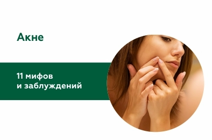 Акне — в чем мы заблуждаемся?