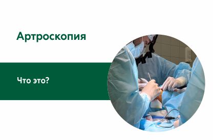 Артроскопия. 