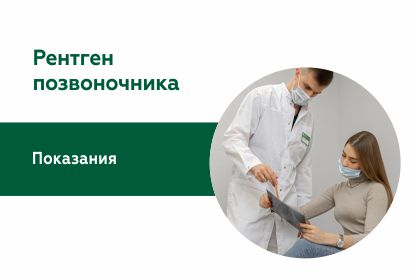 Рентген позвоночника