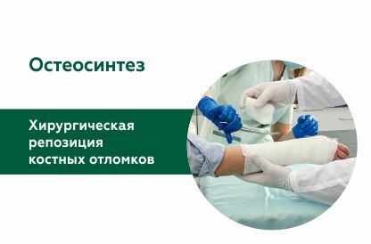 Артроскопия. 